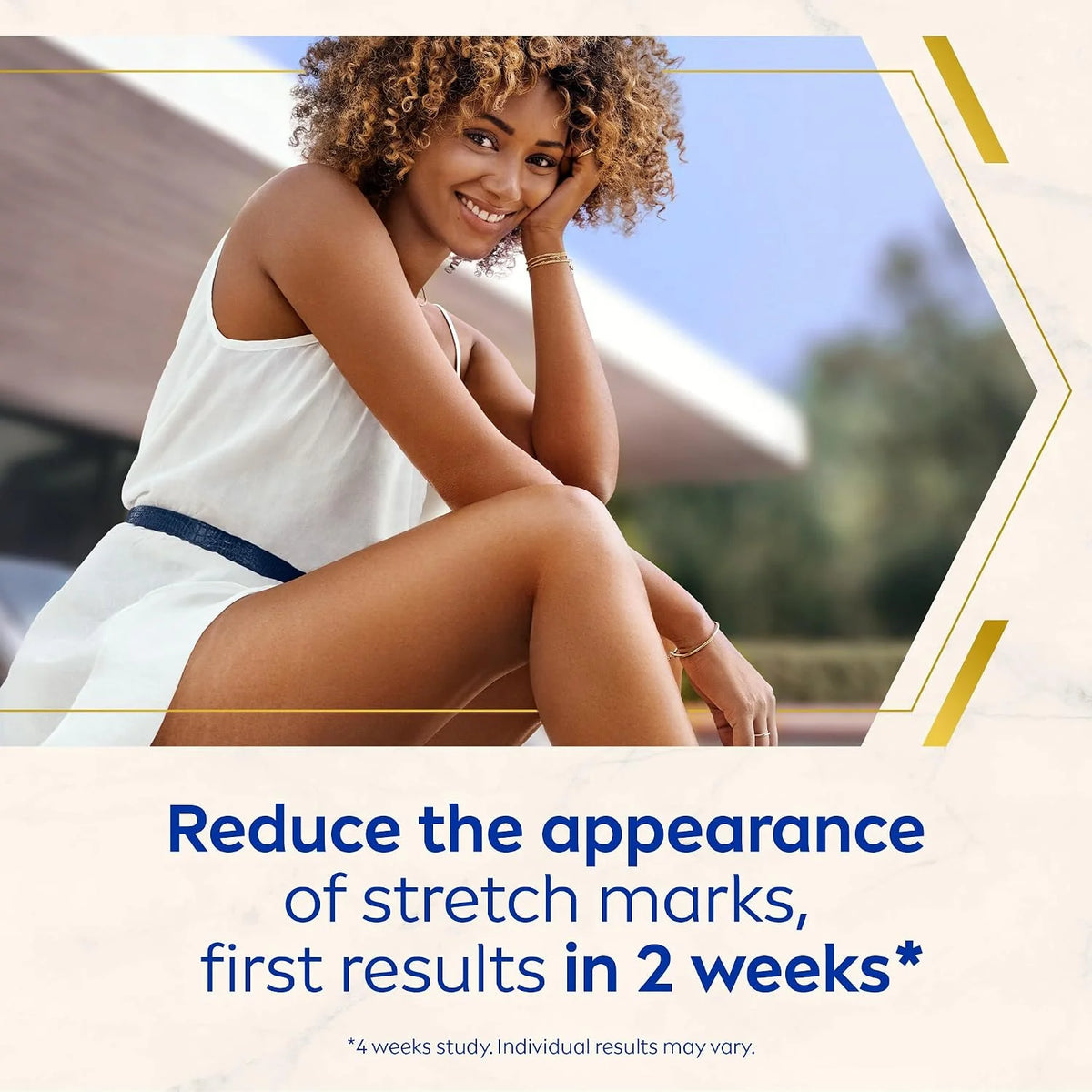 NIVEA Luminous 630 Body Oil Serum Anti Stretch Marks (100ml), Skincare Serum with Luminous 630 Visibly Reduces Stretch Marks in 2 weeks, Starts Working From Day 1